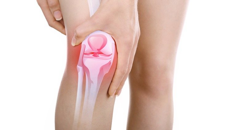 La bursitis puede producirse en el tendón rotuliano