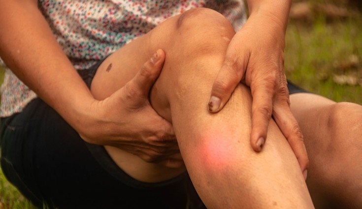 Las castañas tienen poder antiinflamatorio