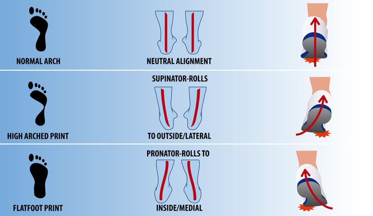 Gráfica que representa los tres tipos de pisada