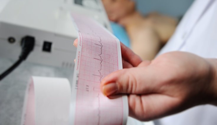 En una mujer de 30 años no es lo más correcto tener 196 latidos por minuto