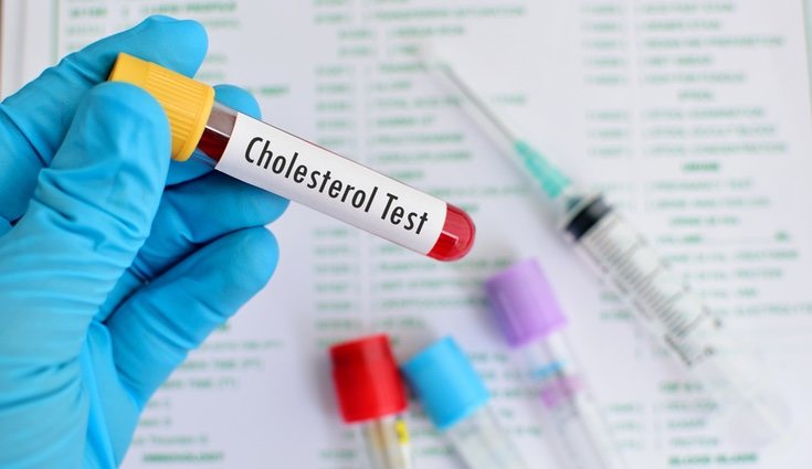 Este producto reduce los niveles de colesterol y reporta beneficios