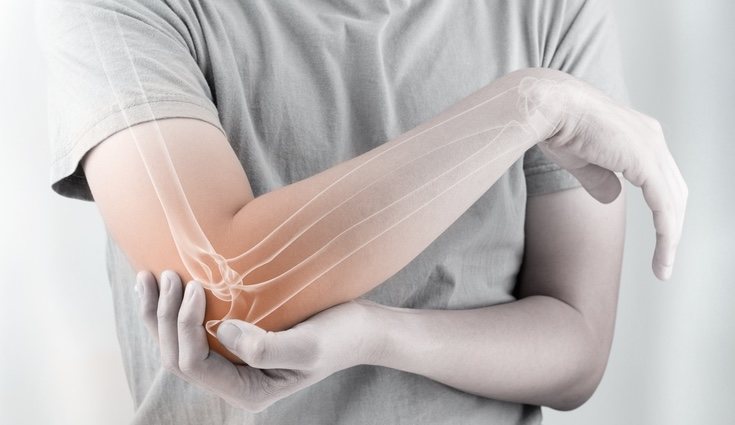 El dolor en las articulaciones puede ser síntoma de cansancio muscular