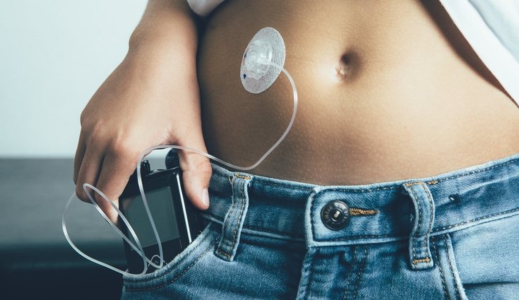El higo es un buen remedio natural para los que sufren diabétes