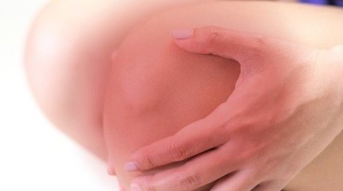 ¿Qué es la bursitis en la rodilla?